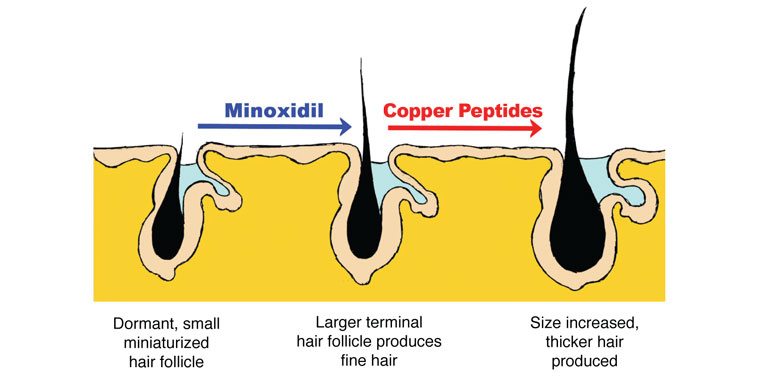 wann wirkt minoxidil